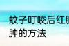 蚊子叮咬后红肿怎么办 蚊子叮咬后红肿的方法